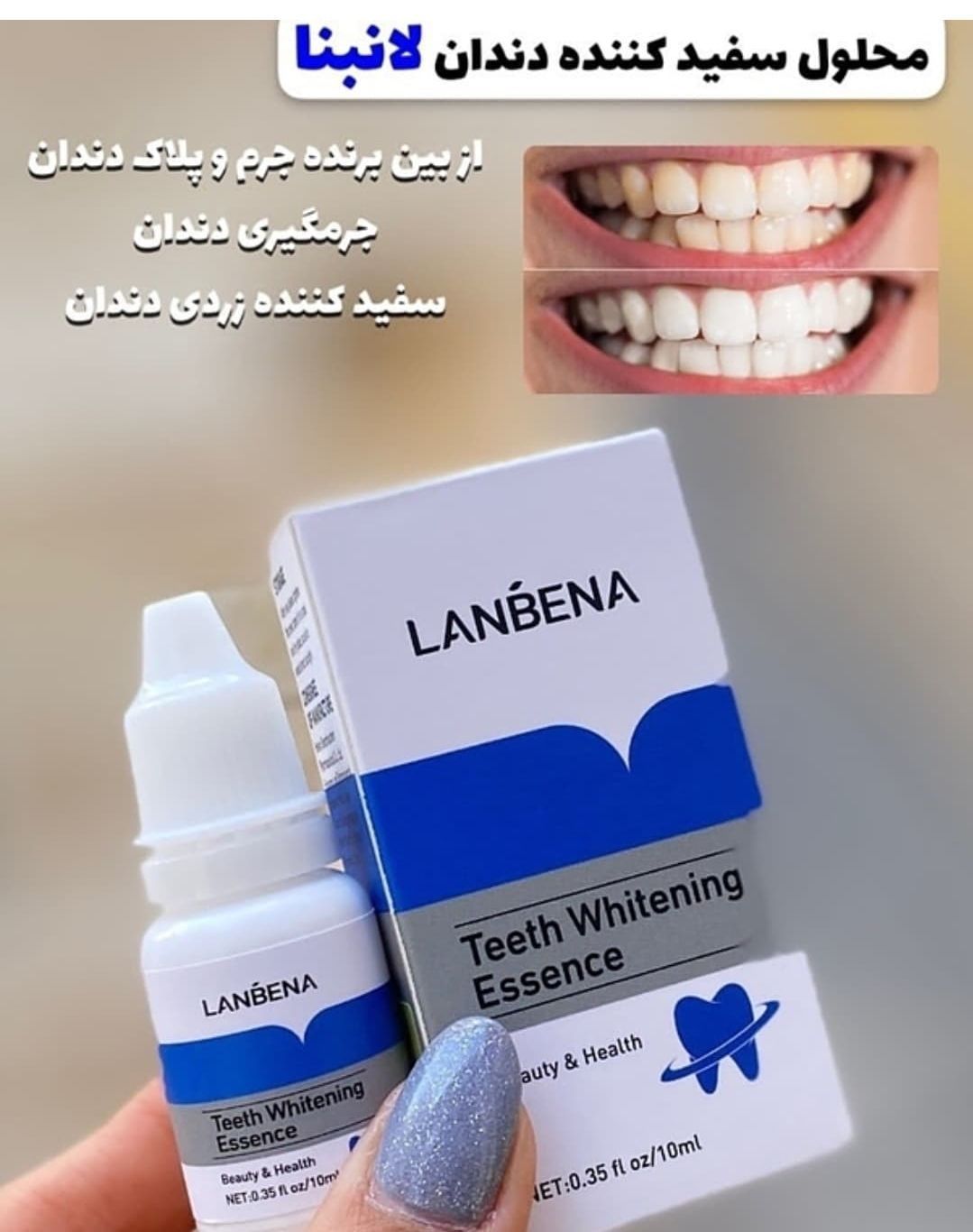 قطره سفید کننده دندان لانبنا